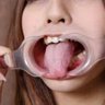 Profilbild von 強制口開け器