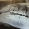 Lazytooth™️ 的头像