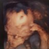 Düşünen Bebek profil fotoğrafı